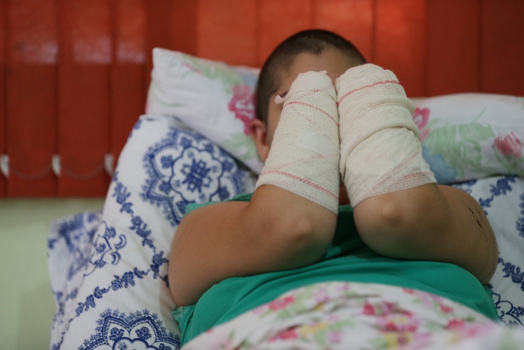 Jovem teve mãos decepadas pelo companheiro (Foto: Diego Vara/Agência RBS)